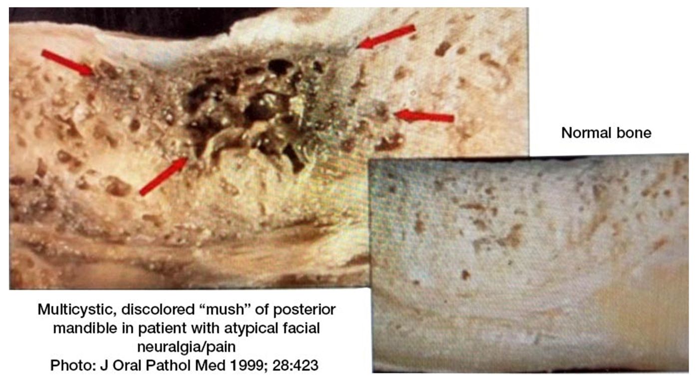 odontologia biologica en clinica dental vazquez troche Vilagarcía